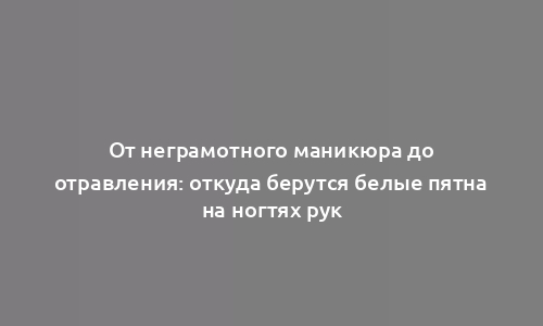 От неграмотного маникюра до отравления: откуда берутся белые пятна на ногтях рук